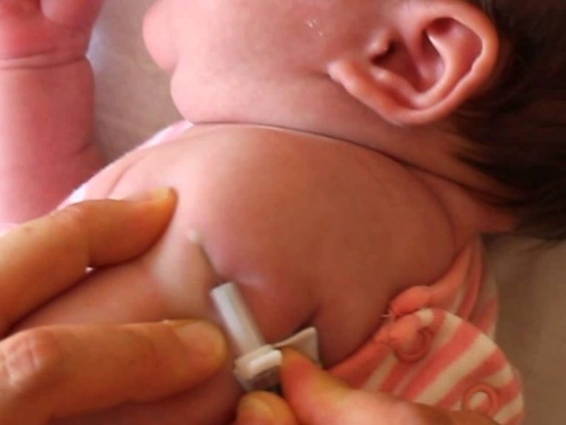 La medida garantiza acceso inmediato a la vacuna contra la tuberculosis desde el nacimiento.